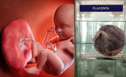 Pakistan's mega placenta smuggling syndicate feeding global anti-aging trade