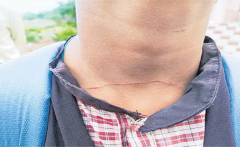 Anantapur Model School Hostel Blade Attack Incident In Andhra Pradesh