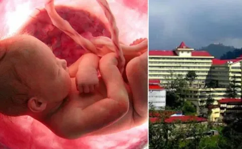 Rare Medical Marvel Fetus in Fetu Discovered in Unborn Babys Mouth in Shimla
