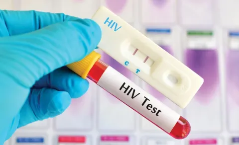 HIV Cases Rising in Medak