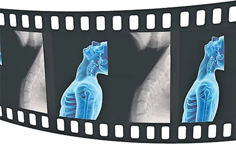 Explanation of Dynamic Digital Radiography