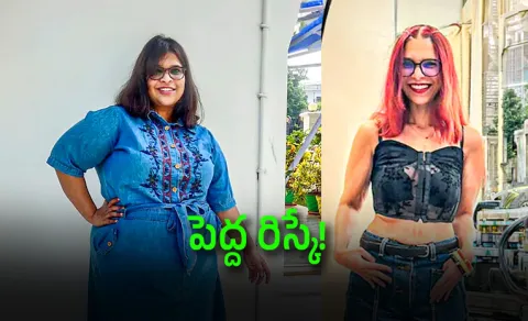 she lost 70 kg after bariatric surger check her success story
