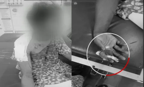 Blade Batch Attack On Supriya At Tirupati