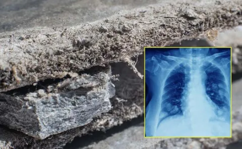 Asbestos Dangers Health Risks Experts Warning