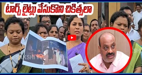 Pushpa Sreevani Strong Counter To Atchannaidu Over Bhadragiri Government Hospital Specialities 1