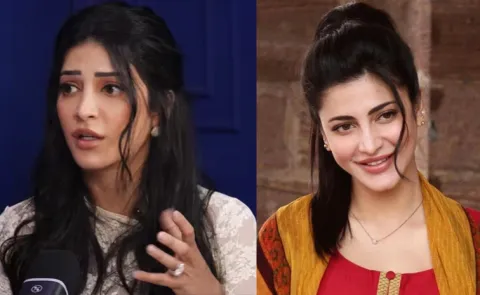 Shruti Haasan Opens Up About Her Battle With Pcos Endometriosis Dysmenorrhea On Podcast
