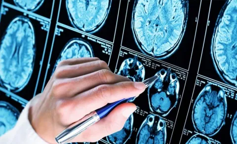 Can a 5 Minute Test Detect Alzheimers