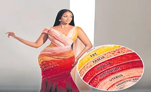 Miss Uganda 2026 Elle Muhoza C-Section Inspired Gown