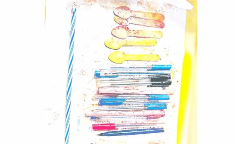 13 pens 5 spoons candle found in insane woman stomach