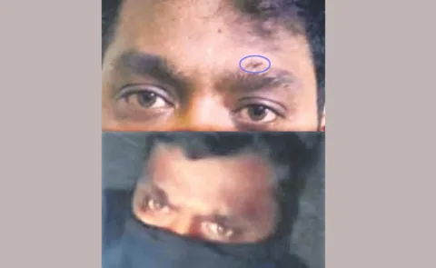 Mask Thief Caught By Scar