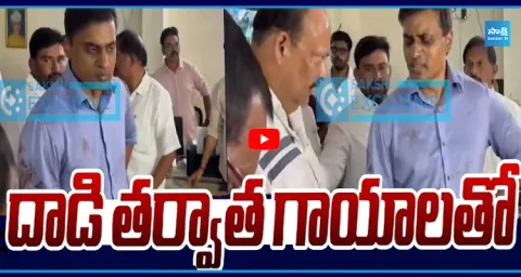  MP Mithun Reddy Exclusive Visuals After TDP Leaders Attack 1