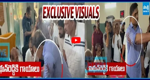  MP Mithun Reddy Exclusive Visuals After Injury 1
