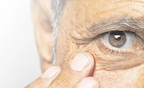 Long-Term Use of Tadalafil Linked to Optic Nerve Damage