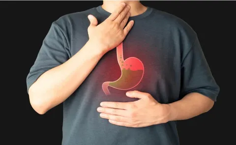 Health Tips: Heartburn: What It Feels Like Causes and Treatment