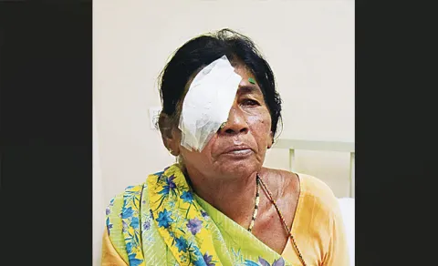 Sircilla Eye Surgery Incident
