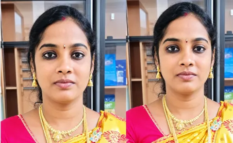 Pregnant Women Operation Incident In Srikakulam