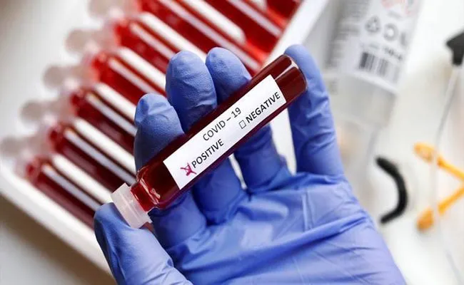 TS Government Released The Bulletin On Corona Virus - Sakshi