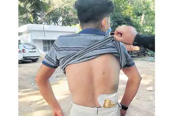 Gang War Between Two Groups In Hyderabad - Sakshi