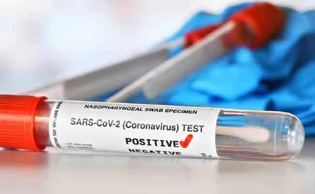 Coronavirus: 3603 Positive Cases Registered In Telangana - Sakshi