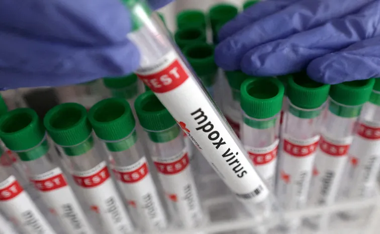 India first Mpox clad 1 case in Kerala