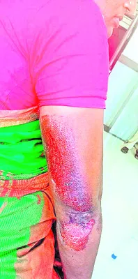 మహిళపై కర్రలతో దాడి