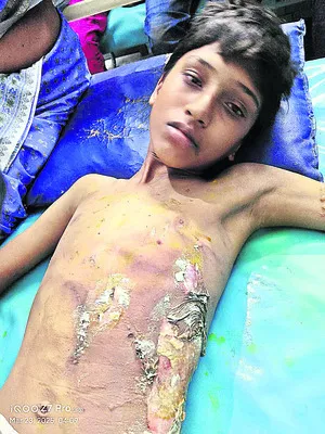 మైదుకూరు జాతరలో  అపశ్రుతి
