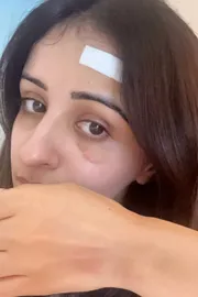 Actress Anshu Forehead Injury Details Latest3