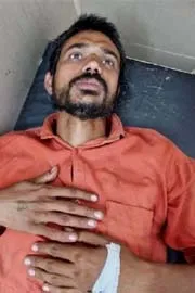 UP Man Performs Surgery On Himself Watching YouTube Videos6