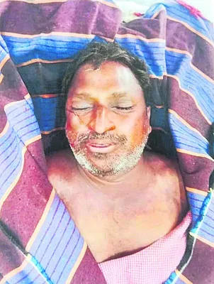 చికిత్సపొందుతూ వ్యక్తి మృతి 