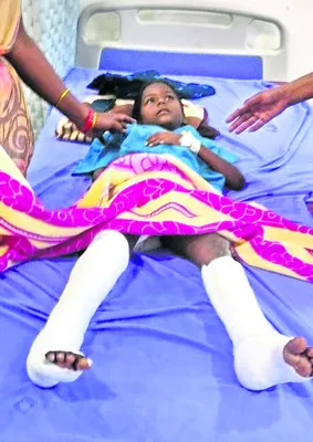 కాంట్రాక్టర్‌ నిర్లక్ష్యం  చిన్నారికి తీవ్రగాయాలు 
