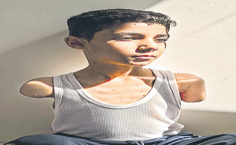 Portrait of injured Gaza boy named press photo of the year2