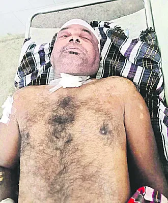 రోడ్డు ప్రమాదంలో గాయపడిన వ్యక్తి మృతి