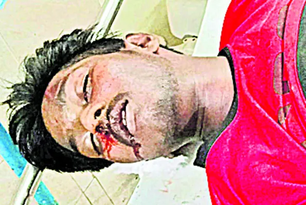 ఆగి ఉన్న లారీని ఢీ కొట్టిన బైక్‌..  యువకుడి దుర్మరణం 