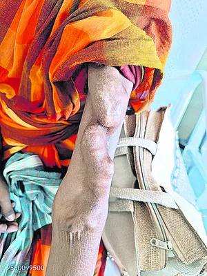 నా చ