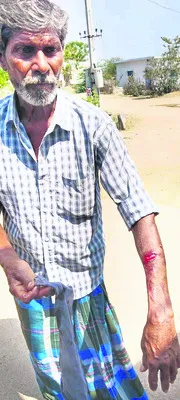 కోతుల దాడిలో  వృద్ధుడికి గాయాలు
