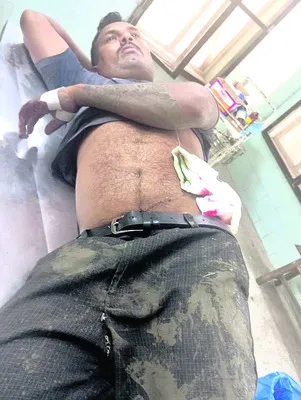అడవి పందుల దాడిలో ముగ్గురికి గాయాలు