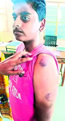 విద్యార్థిని చితకబాదిన స్కూలు యాజమాన్యంపై చర్యలకు డిమాం