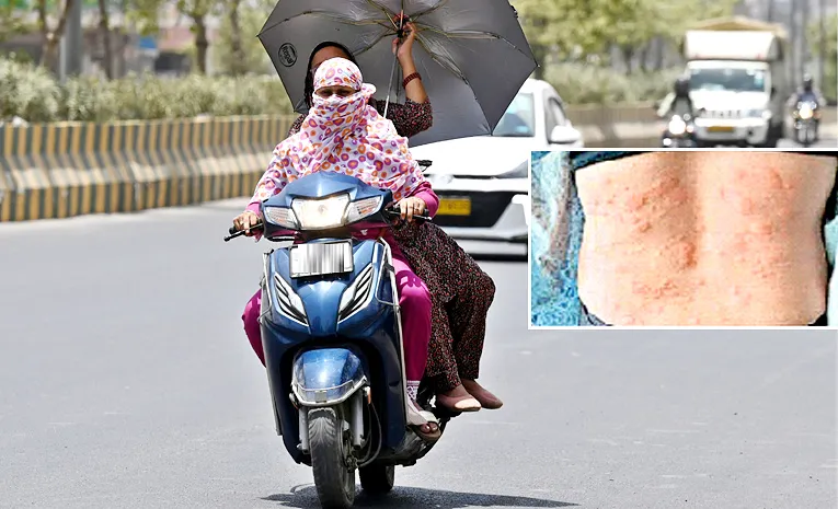 Skin Care in Hot Summer; Check full details inside3