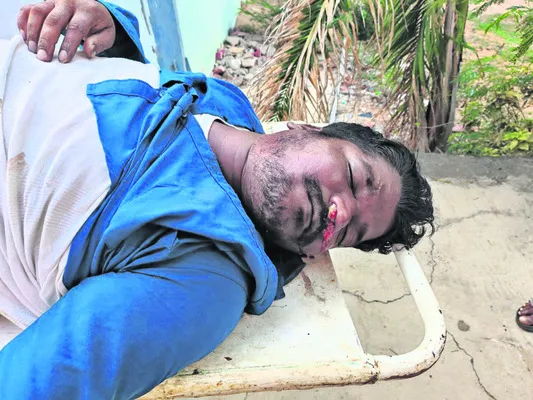 పెళ్లిలో భోజనం చేస్తూ ఒకరి మృతి