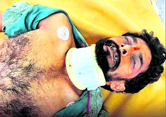 రోడ్డు ప్రమాదంలో గాయపడిన వ్యక్తి మృతి