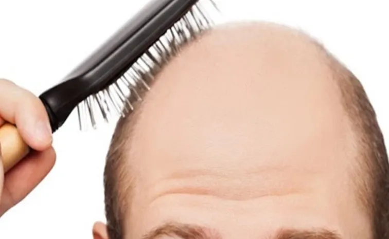 do you know Regrowing hair on a bald head is possible