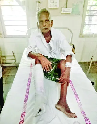 టీడీపీ కార్యకర్త దాడిలో వ్యక్తికి తీవ్ర గాయాలు