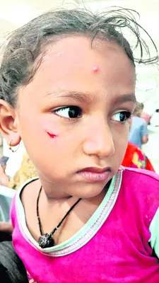 కుక్కల దాడిలో చిన్నారికి గాయాలు