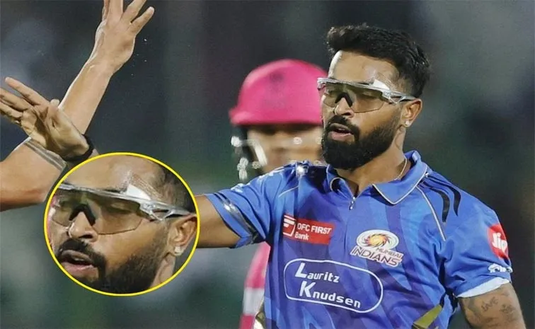 IPL 2025, RR VS MI: Hardik Pandya Played The Match With 7 Stitches Above Left Eye