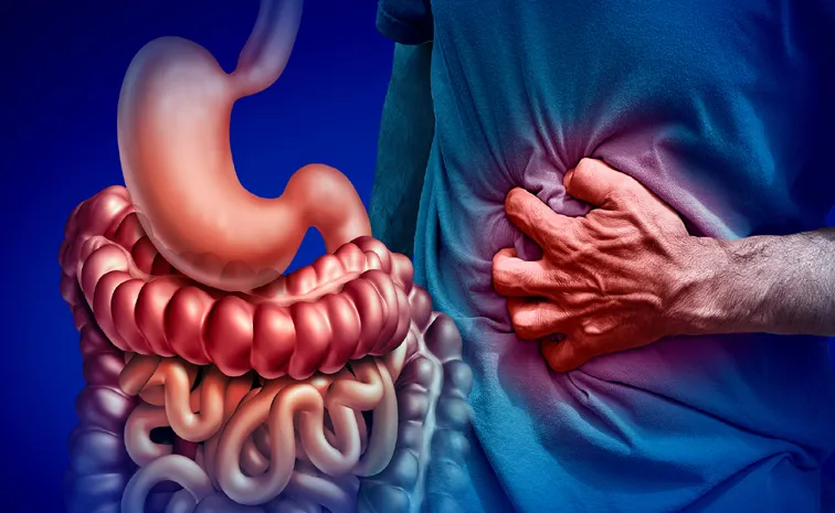 IBD లక్షలమందిని ప్రభావితం చేస్తున్న వ్యాధి, మొహమాటం వద్దు!