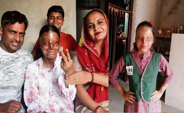 Dreaming of IAS 17 Year Old kafi Acid Attack Survivor Tops