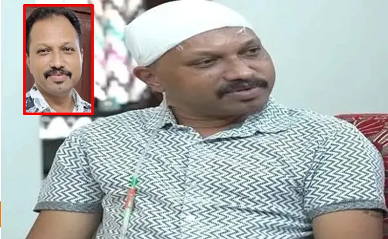 Kerala man battles flesh-eating bacteria After Hair transplant