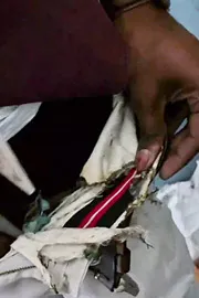 Annamayya District: Mobile Phone Explodes In Student Pants Pocket1
