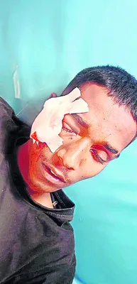 తమ్ము