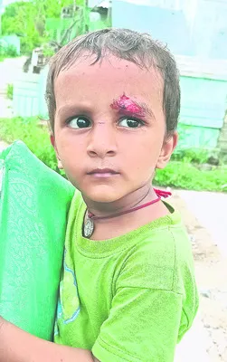 వెల్గటూర్‌లో పిచ్చి కుక్క వీరంగం